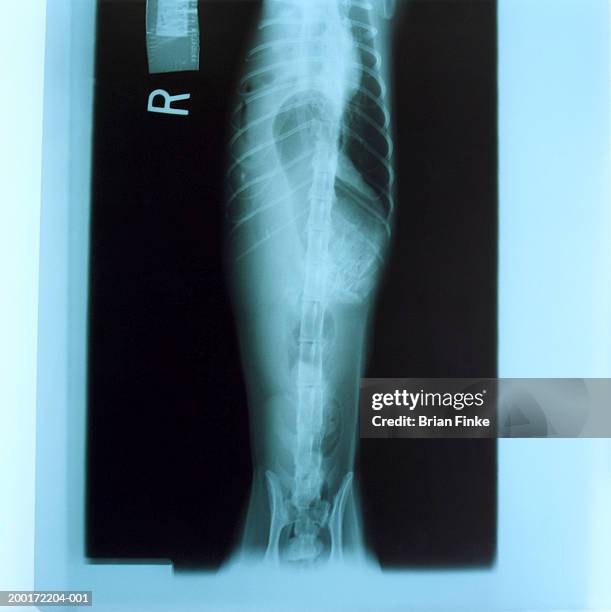 Dog In Rib Cage Dog X Rays Photos and Premium High Res Pictures - Getty Images