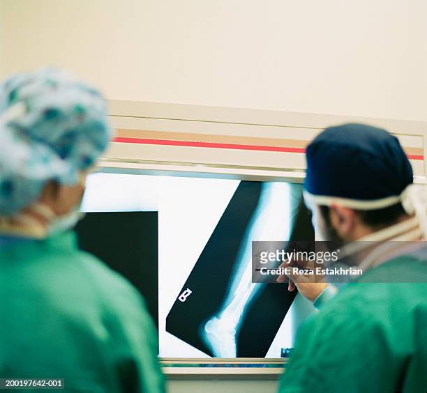two surgeons looking at x-ray of broken leg, rear view - pierna fracturada fotografías e imágenes de stock