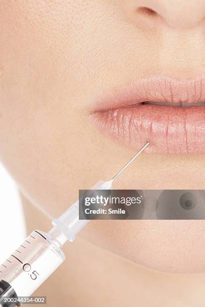 young woman receiving injection in lip, mid section, close-up - lip injections stockfoto's en -beelden