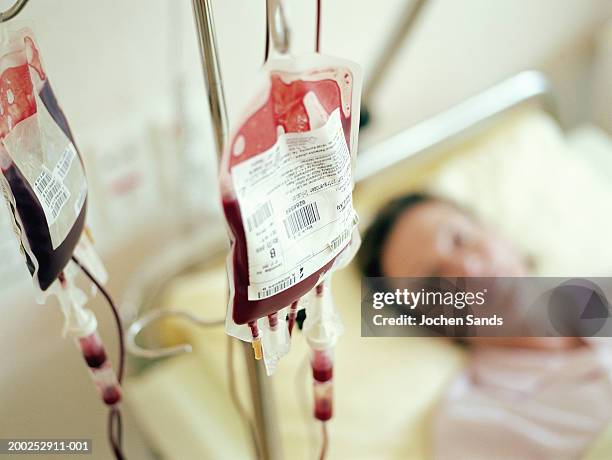 woman lying in hospital bed (focus on iv drips filled with blood) - blutkonserve stock-fotos und bilder