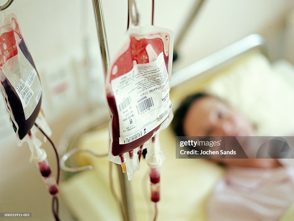 Woman lying in hospital bed (focus on IV drips filled with blood)