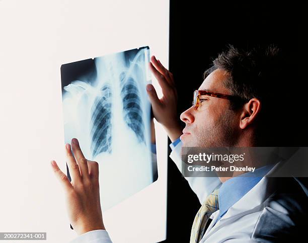 young male doctor examining x-ray of chest, side view - xray light box stock pictures, royalty-free photos & images
