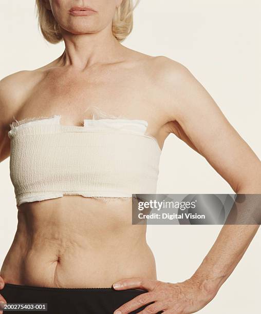 mature woman with bandage around chest, hands on hips, mid section - aumento dos seios imagens e fotografias de stock