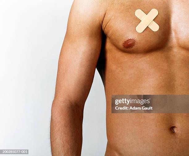 Cal Spot R Chest 806 White Spots On Chest Stock Photos, High-Res Pictures, and Images ...