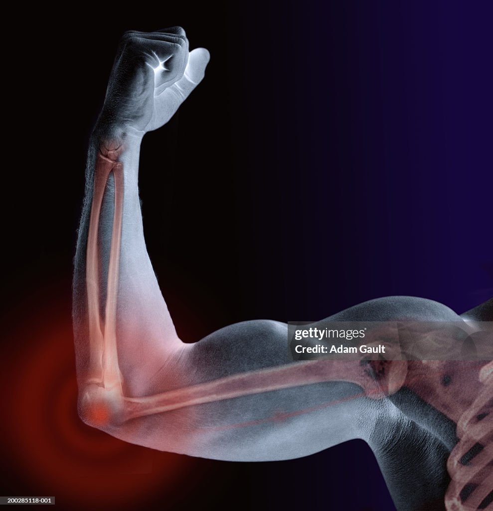 Man flexing bicep, skeleton visible, close-up (Digital Composite)