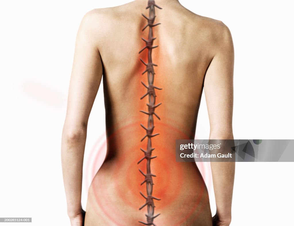 Woman with barbed-wire along line of backbone (Digital Composite)