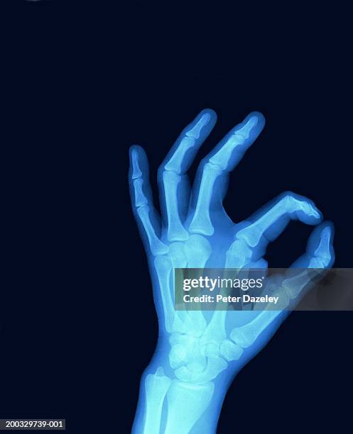 hand making 'ok' sign (x-ray, digital enhancement) - ok hand stock pictures, royalty-free photos & images