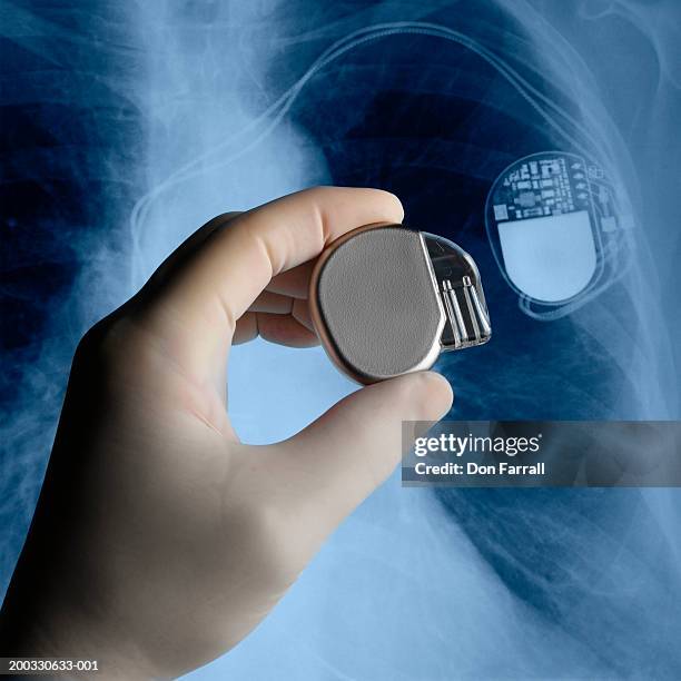 Foto Pacemaker Pacemaker Hand Fotografías e imágenes de stock - Getty Images