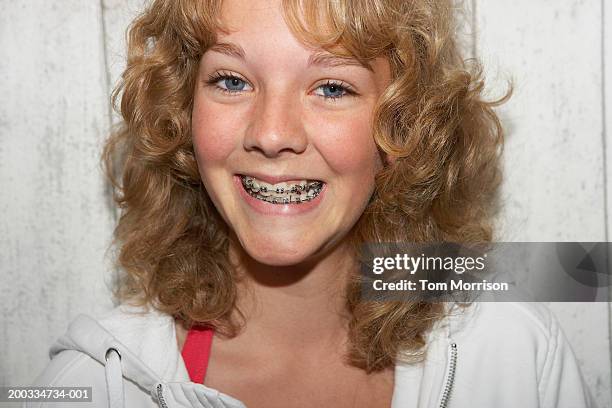 Teenage Girl Wearing Braces Smiling Close Up Portrait High-Res