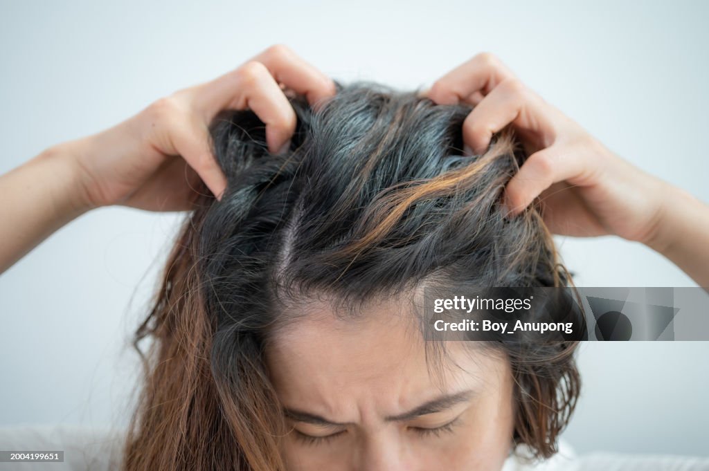 Cropped shot view of Asian woman having Itchy scalp problem.