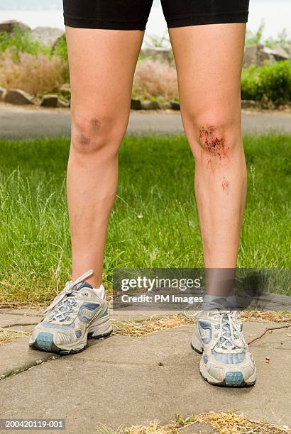 female jogger with injured knee, low section - leg wound fotografías e imágenes de stock