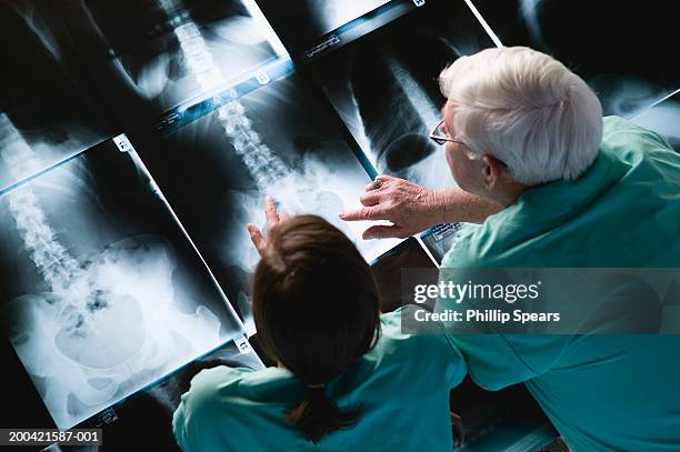 two doctors looking at x-rays, overhead view - man rear view grey hair closeup stock pictures, royalty-free photos & images