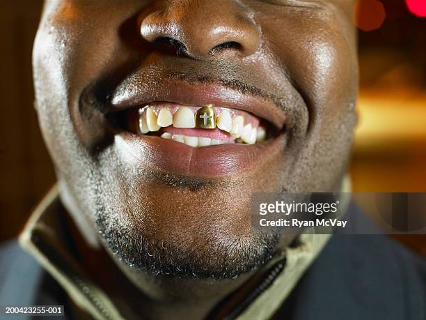 man with gold tooth, smiling - capped tooth imagens e fotografias de stock