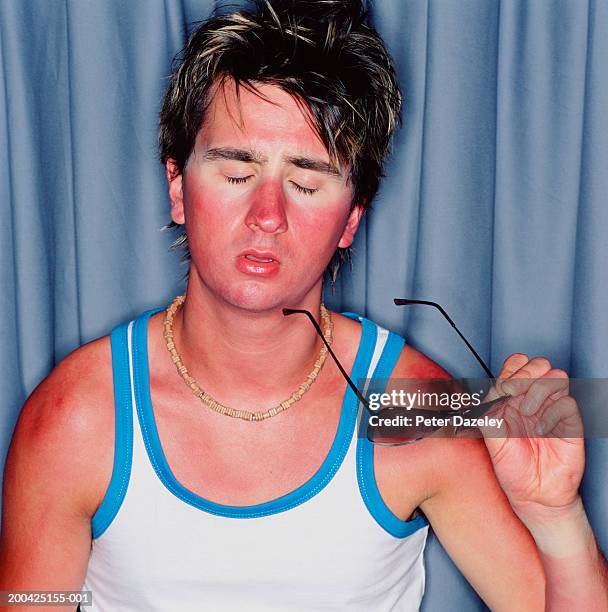 young man with sunburn, holding sunglasses, eyes closed, close-up - sunburn stock-fotos und bilder