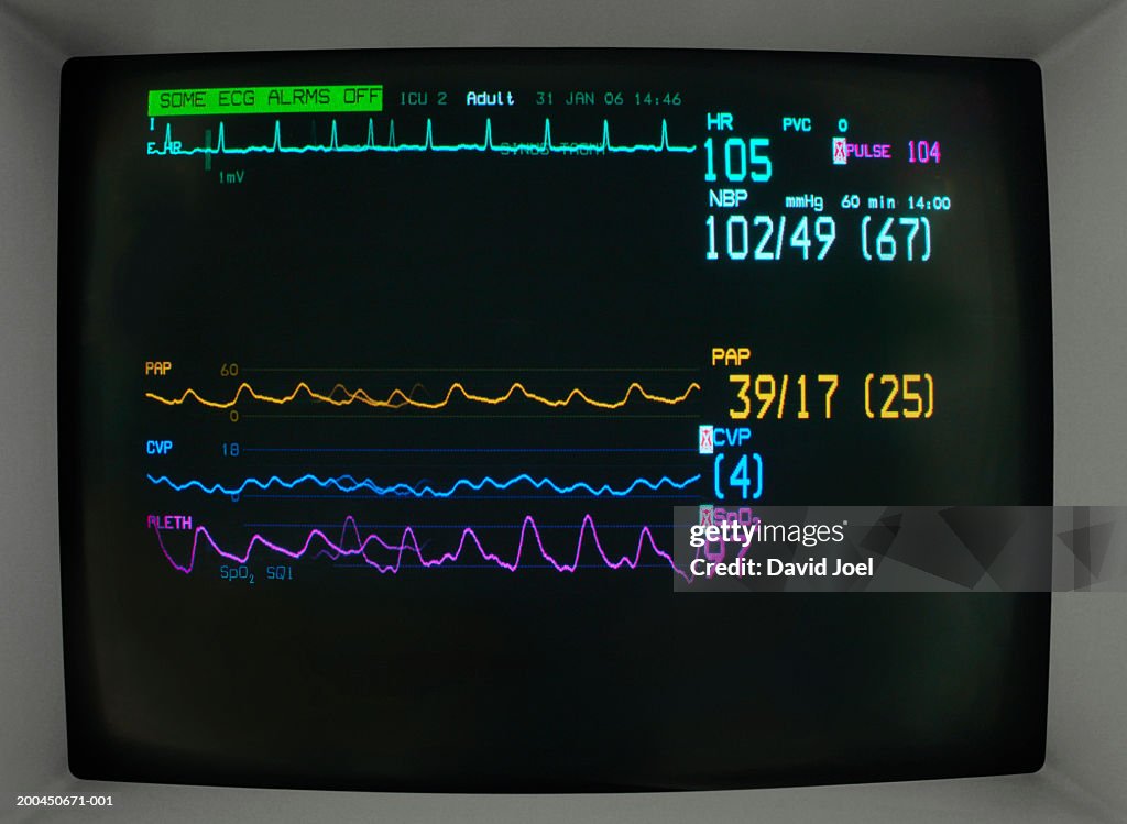 Pulse trace monitor, close-up