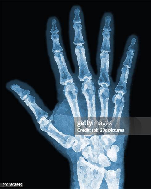 hand man 003 - x ray of right hand stock pictures, royalty-free photos & images