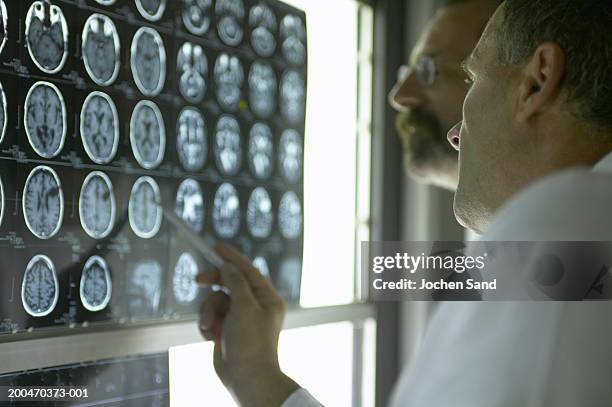 "two male doctors looking at x-rays and mri scans, pointing at scan" - magnetresonanztomographie stock-fotos und bilder