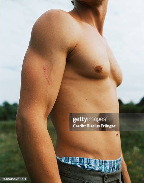 young man, mid section - man scar foto e immagini stock