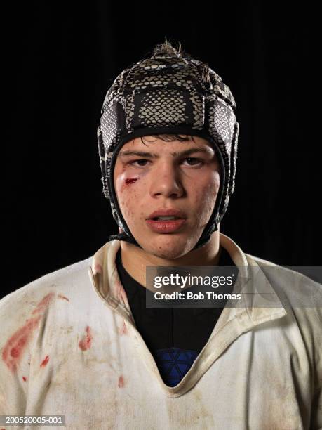 Teenage boy in rugby kit with cut and bruised face, portrait