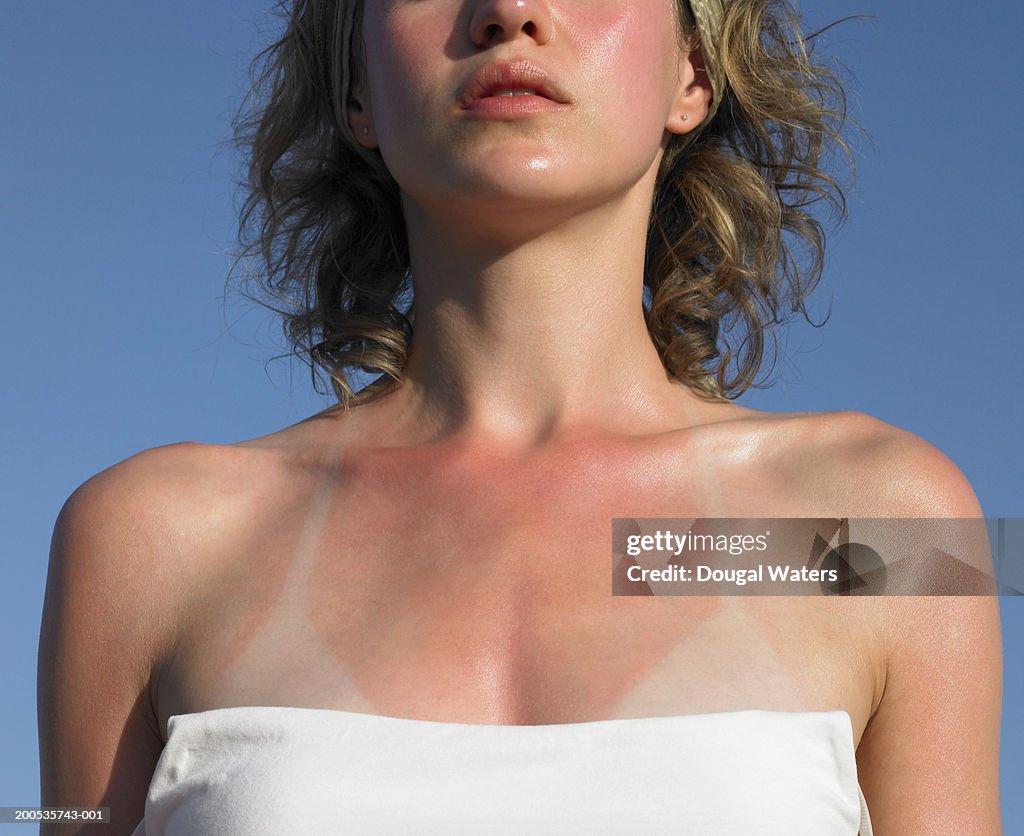 Young woman with sunburn tanlines, mid section