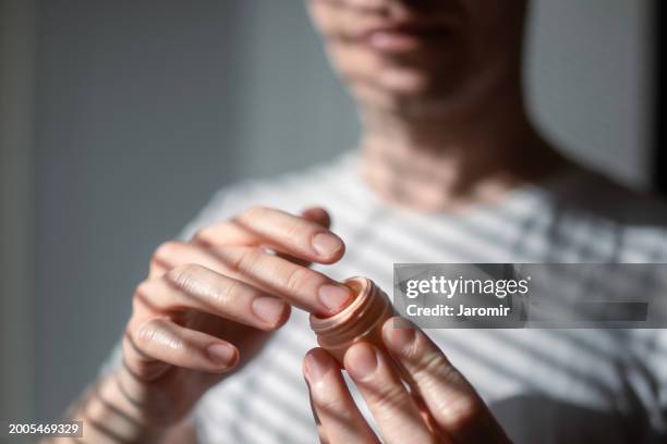 man applying moisturizing lip balm protection - irritation cutanée photos et images de collection