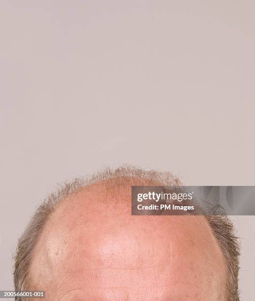 top of balding man's head - top of head stock pictures, royalty-free photos & images