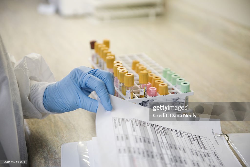 Lab technician with blood samples and medical chart
