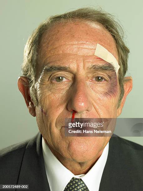 senior businessman with black eye and bleeding nose, portrait - beaten up stockfoto's en -beelden