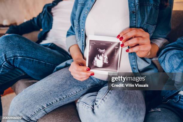 502 Free Ultrasound Stock Photos, High-Res Pictures, and Images - Getty