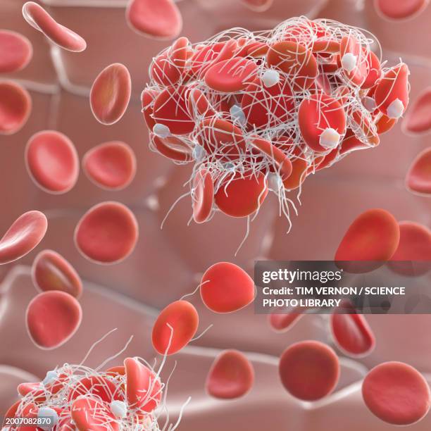 blood clot, illustration - fibrin stock illustrations