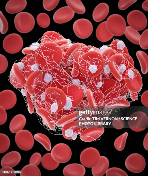 blood clot, illustration - fibrin stock illustrations