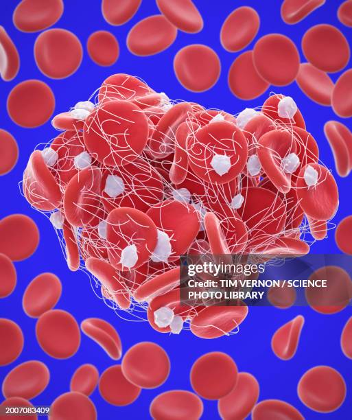 blood clot, illustration - fibrin stock illustrations