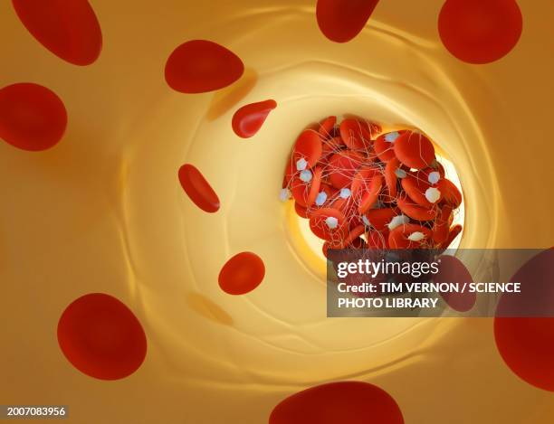 blood clot, illustration - fibrin stock illustrations