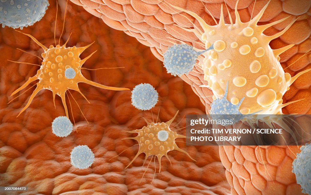 Natural killer T cells attacking cancer cells, illustration
