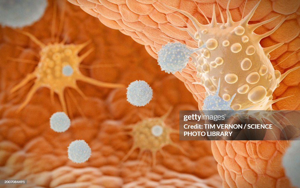 Natural killer T cells attacking cancer cells, illustration