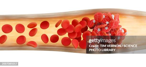 blood clot, illustration - fibrin stock illustrations