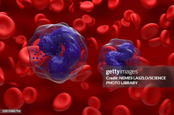 chronic myeloid leukaemia, illustration - cancer illness stock illustrations