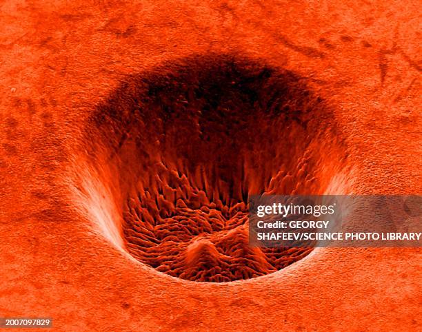 titanium crater formed by a laser, sem - vue au microscope électronique à balayage en réflexion photos et images de collection