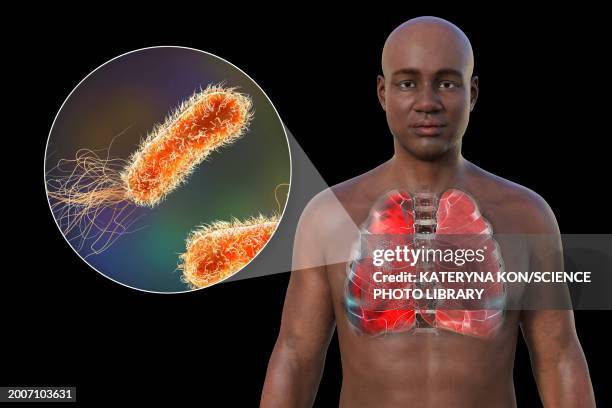 man with lungs affected by pneumonia, illustration - man black background stock illustrations