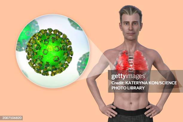 man with lungs affected by covid-19 pneumonia, illustration - male anatomy stock illustrations