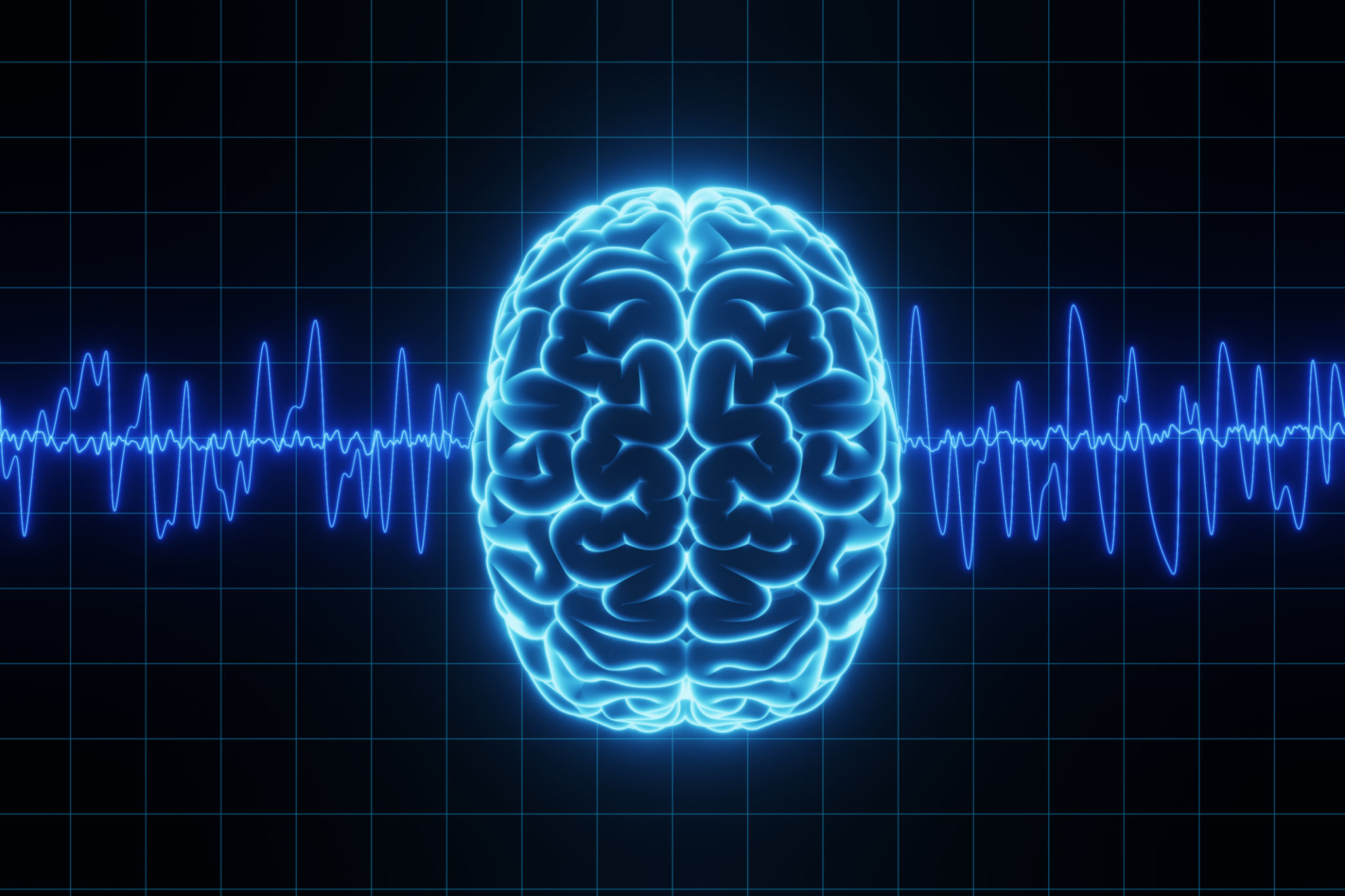 brain activity