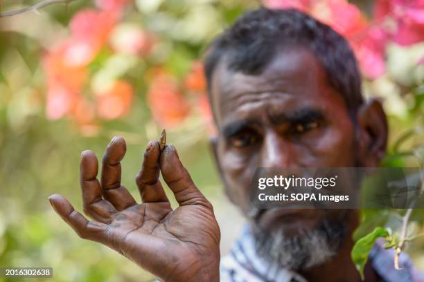 Bangladesh civilian, Shamsul Alam 55 years old holds a bullet that was removed from his body after he was shot. One of his married daughters lived...