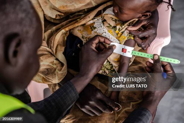 Health worker measures the circumference of a Sudanese child's arm at the clinic of a Transit Centre for refugees in Renk, on February 13, 2024.More...