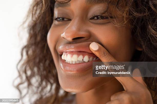 woman showing healthy gums - painful lips stock pictures, royalty-free photos & images
