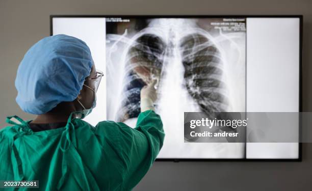 medical student looking at an x-ray at the hospital - röntgenbild bildbanksfoton och bilder