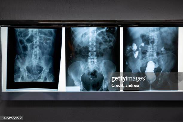 x-ray images of different patients in the radiology room - imagem de raios x imagens e fotografias de stock