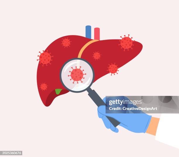 stockillustraties, clipart, cartoons en iconen met human liver with virus cells. doctor examining liver with magnifying glass - virus