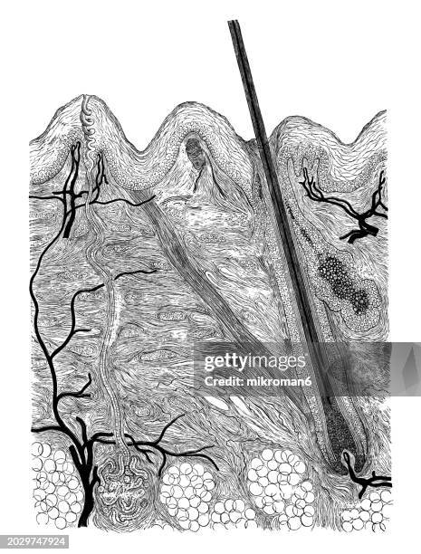 old engraved illustration of vertical cross-section through the human skin - fusto del pelo foto e immagini stock