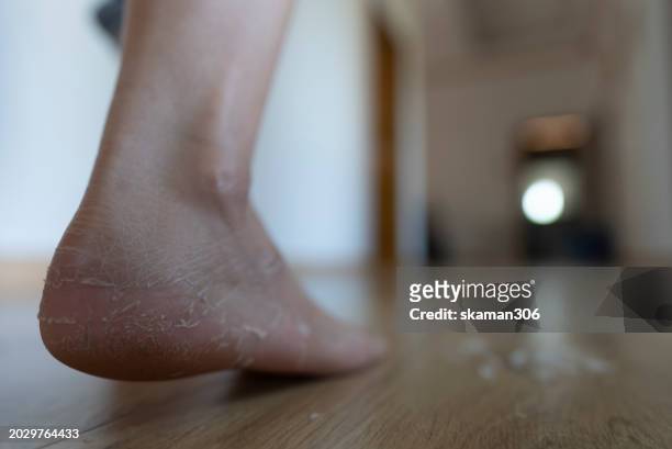 close-up view of a person scratch dry  skin their foot, focusing on self-care and hygiene. - images of ugly feet stock pictures, royalty-free photos & images