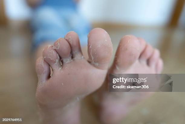 close-up view of a person scratch dry  skin their foot, focusing on self-care and hygiene. - images of ugly feet stock pictures, royalty-free photos & images